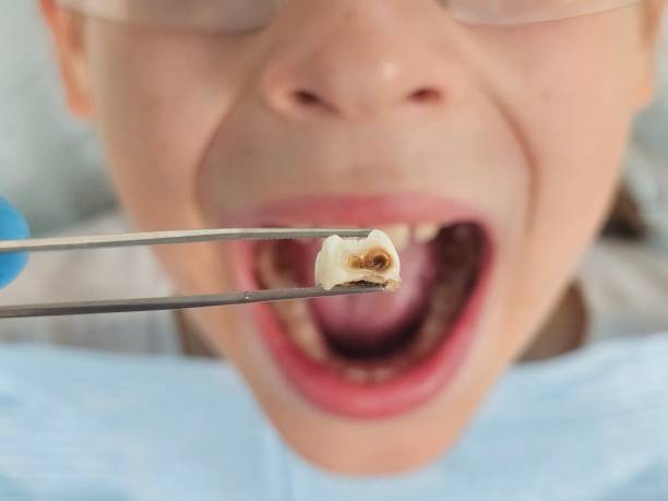 Best Pediatric Emergency Dentist in Sun Village, CA